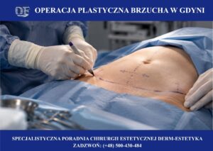operacja plastyczna brzucha gdynia, gdańsk